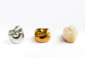silver and gold crowns next to a tooth